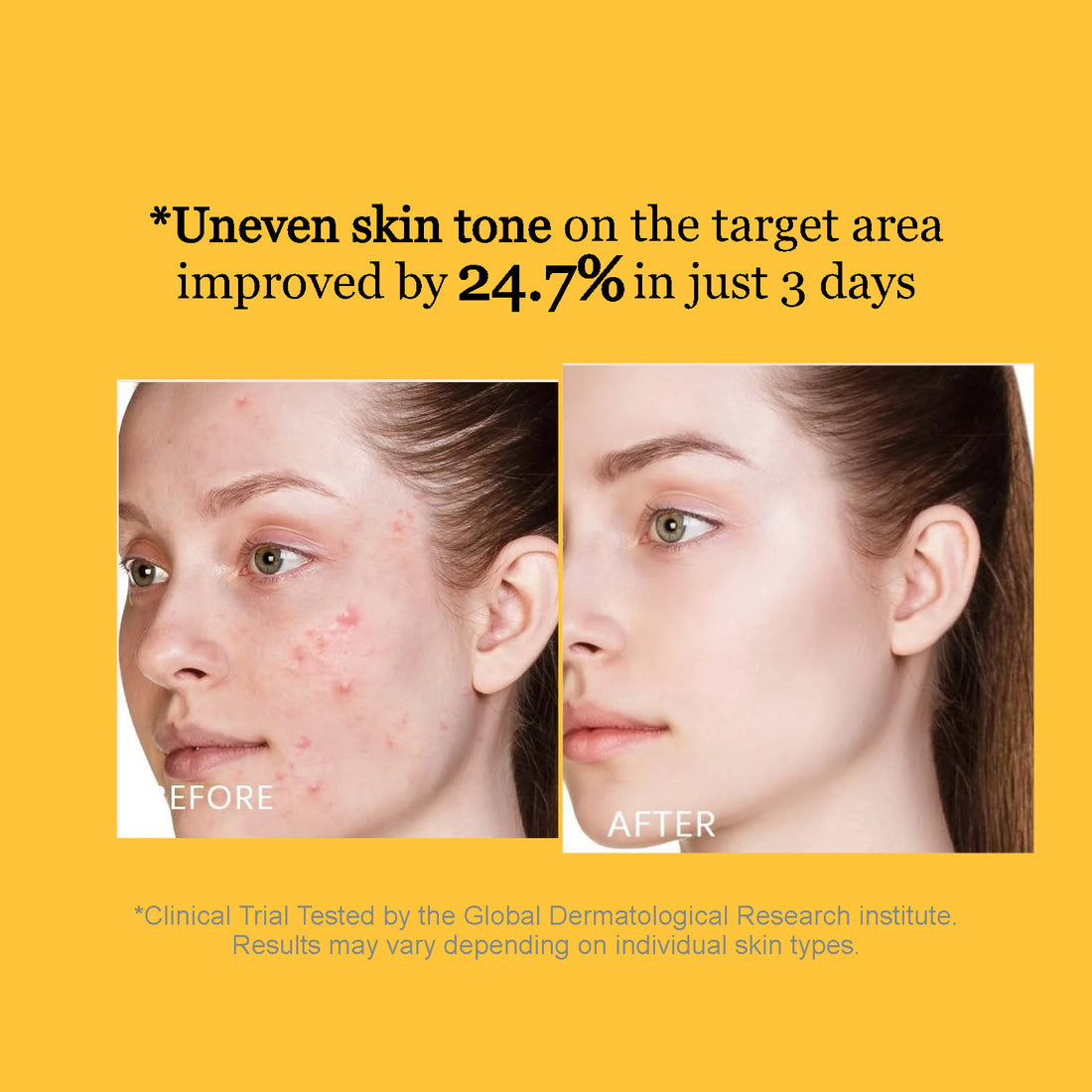 Turmeric Pore Tightening foam